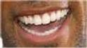 Bouche 4